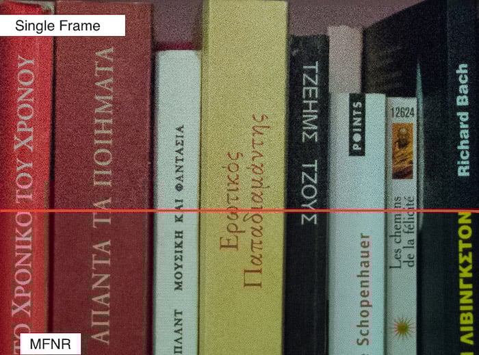 Comparison between a shot before and after doing MNFR.