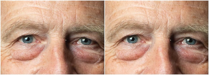 Portrait detail diptych Before and After the eye sharpening on Photoshop